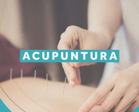 08-acupuntura